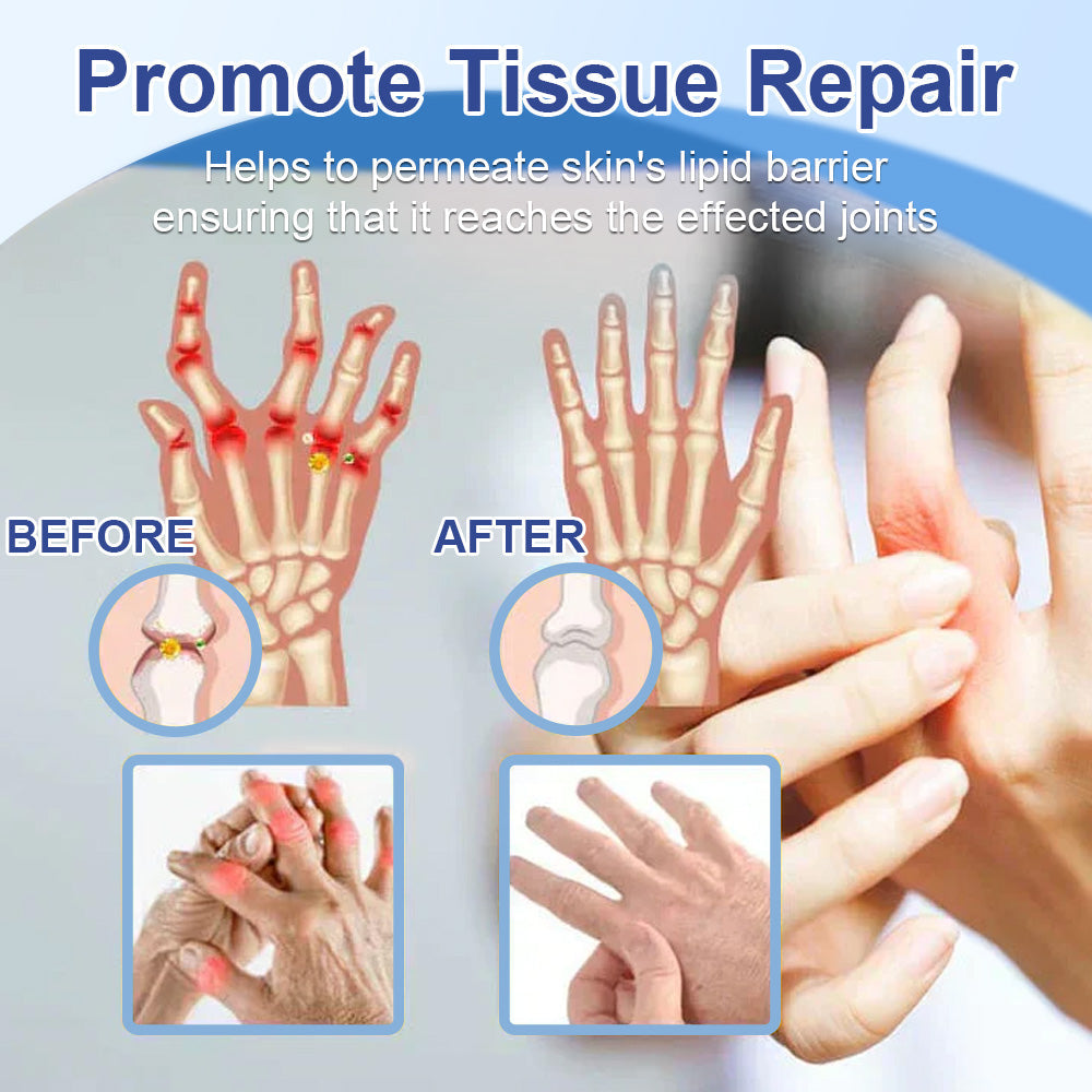 ✨Ourlyard® Magnesium Pain Healing Bone Cream (Treatment for arthritis, neuropathyy, rheumatic diseases, twitches, muscle spasms and sports injuries)