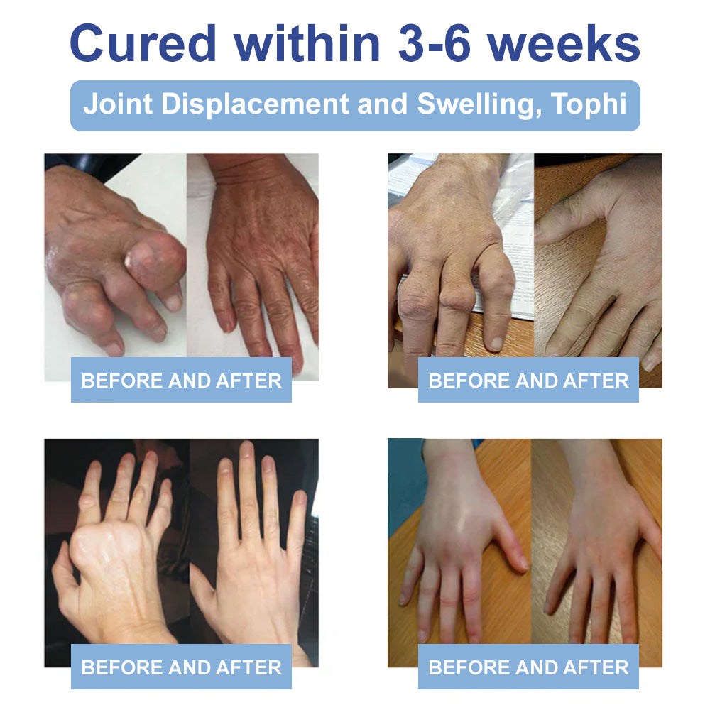 ✨Ourlyard® Magnesium Pain Healing Bone Cream (Treatment for arthritis, neuropathyy, rheumatic diseases, twitches, muscle spasms and sports injuries)