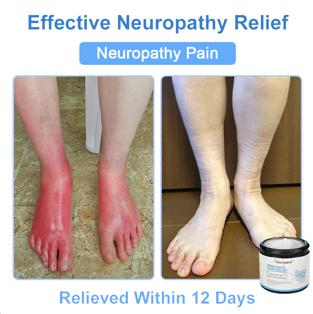 ✨Ourlyard® Magnesium Pain Healing Bone Cream (Treatment for arthritis, neuropathyy, rheumatic diseases, twitches, muscle spasms and sports injuries)